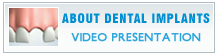 Dental Implants Video Presentation